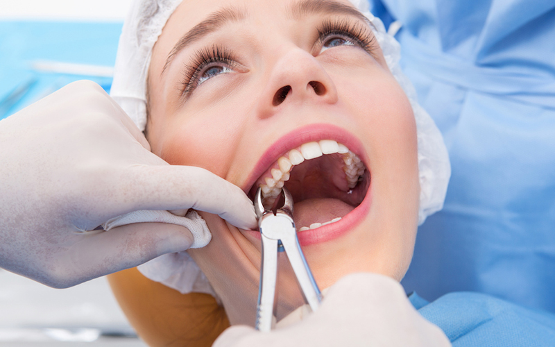 Molar Extraction | Dental Procedure | Oral Surgery Solutions